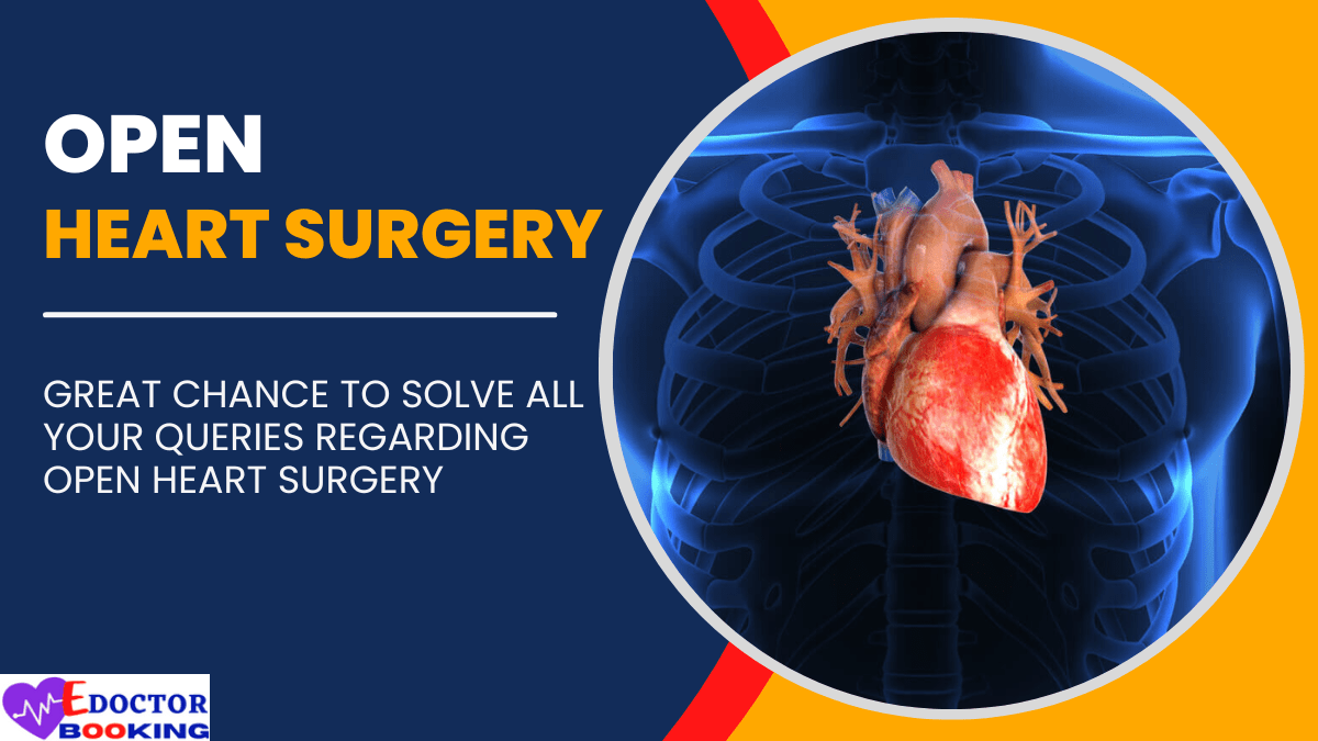 OPEN Heart Surgery Overview - Open heart surgery Procedure - Open heart surgery Cost